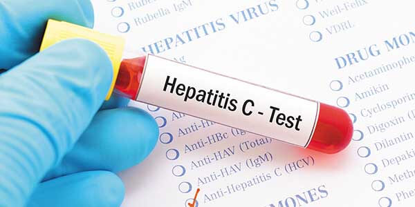 Тест на гепатит С