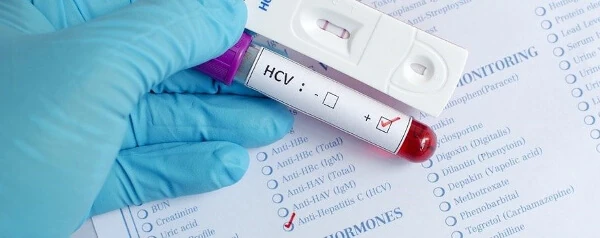 Анализы на гепатит С