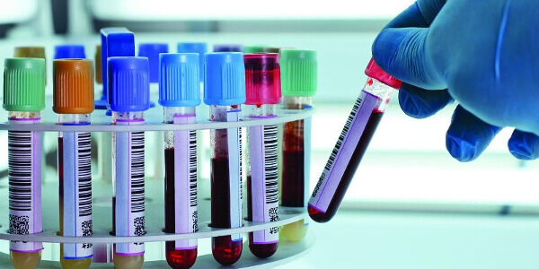 Диагностика гепатита С