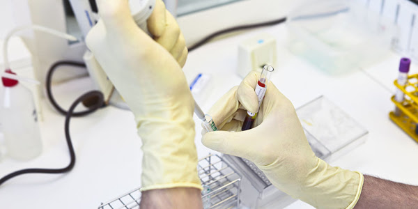 Анализ на гепатит С