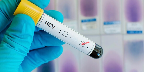 Положительный результат анализа на ВГС