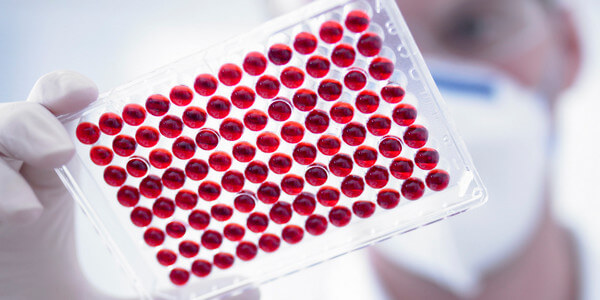 Анализ крови на гепатит