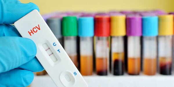 Анализ на гепатит С
