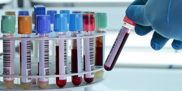 Анализ крови на ВГС